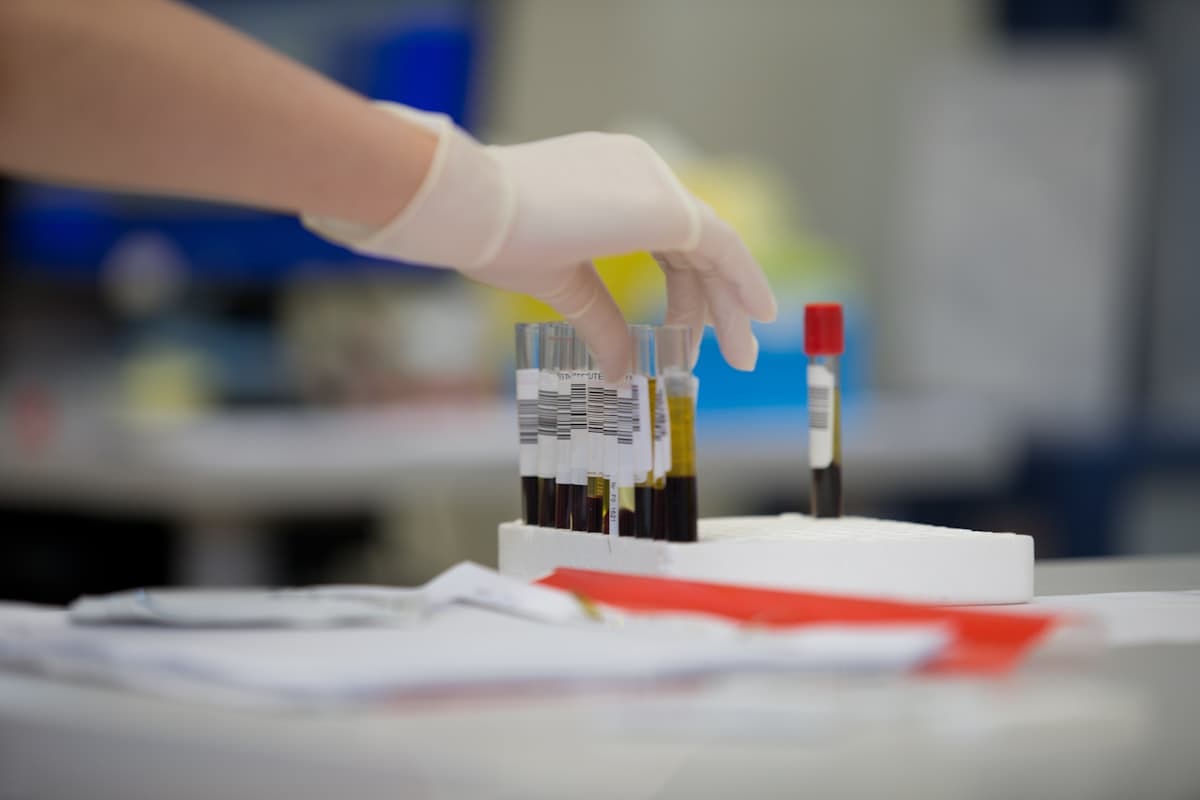 Blood sample tubes collected for at-home lab diagnostics
